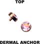 Top for dermal anchor 11025