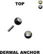Top for dermal anchor 14198